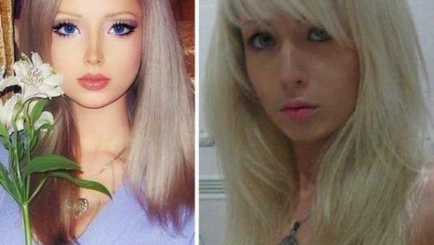 Le foto di Valeria Lukyanova prima e dopo la chirurgia estetica