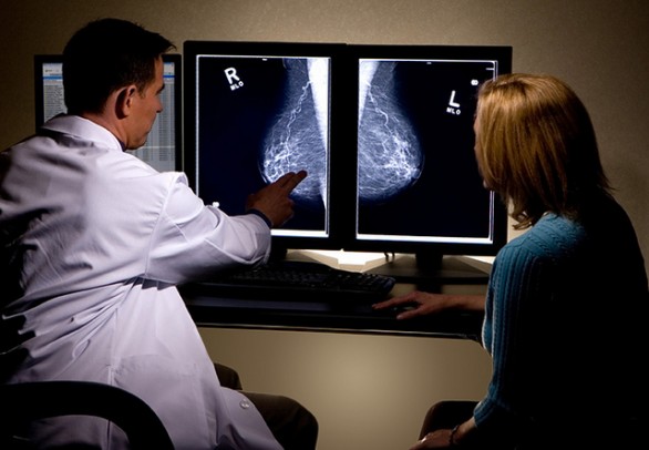 Quando fare la mammografia e a chi rivolgersi