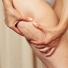 Come combattere la cellulite con metodi naturali, dieta e ginnastica in casa