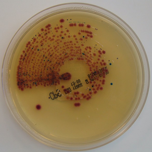 Come curare la cistite facilmente senza medicinali con i rimedi naturali