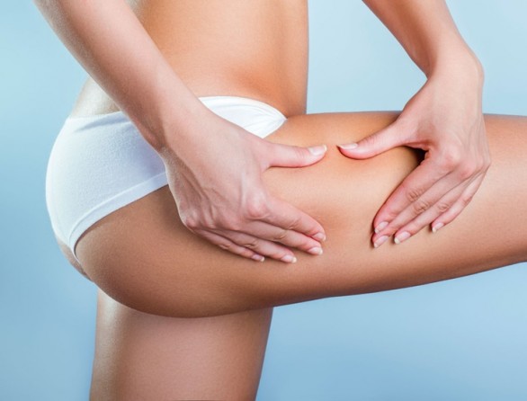 Prevenire la cellulite con esercizi fai da te l&#8217;alimentazione giusta