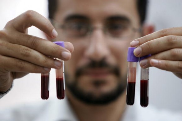 La composizione del sangue e i valori normali di riferimento