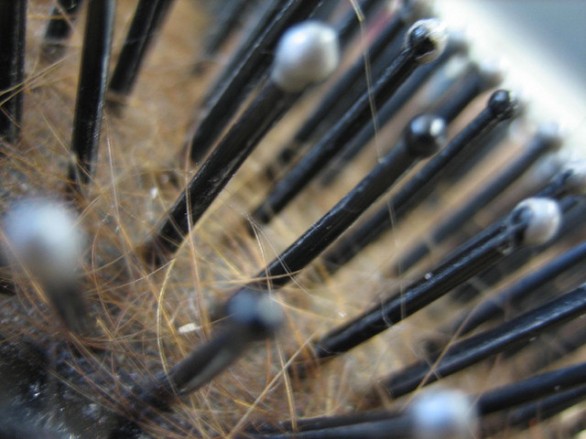 I rimedi casalinghi per combattere la forfora nei capelli