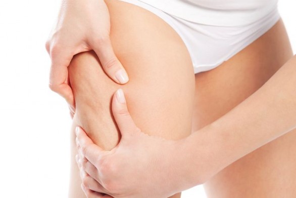 La cavitazione contro la cellulite, il prezzo del trattamento e le controindicazioni