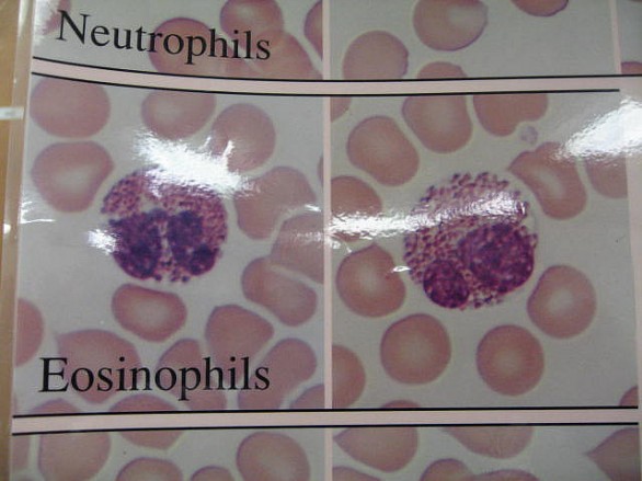 Eosinofili alti o bassi, quando preoccuparsi e perché