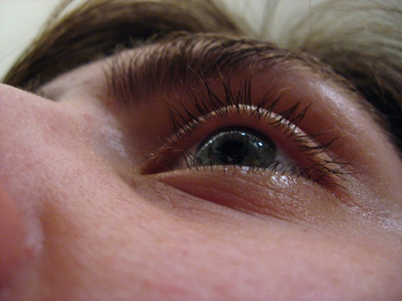Come prevenire e curare gli occhi gonfi