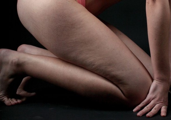 Il massaggio connettivale contro la cellulite, come funziona e quanto costa