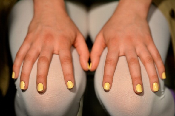 Unghie gialle delle mani e dei piedi: le cause e i rimedi efficaci