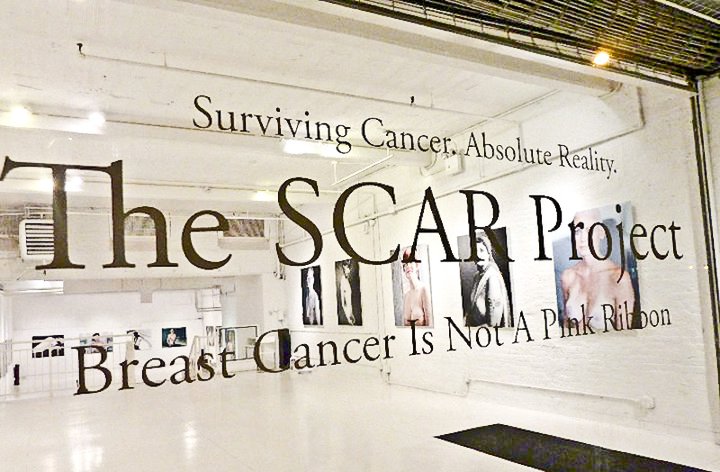 Su Real Time &#8220;Gli scatti della rinascita&#8221;, per parlare di cancro al seno