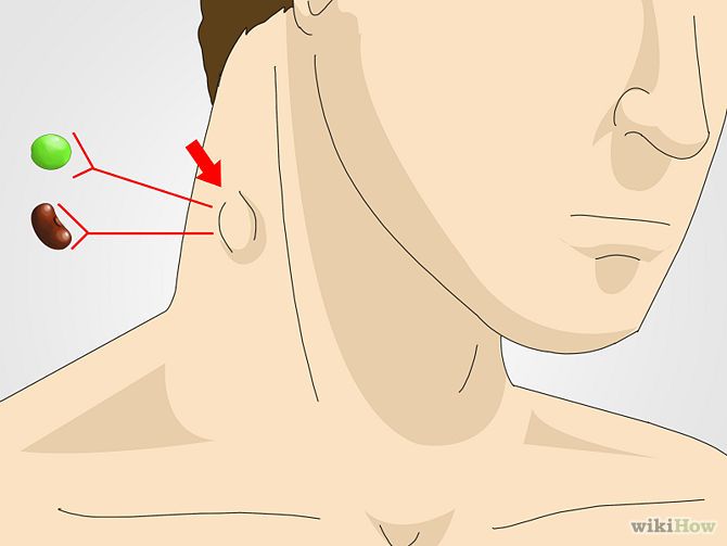Linfonodi al collo ingrossati: le cause e le terapie da seguire