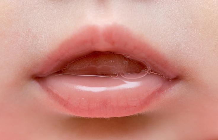 Eccessiva salivazione: le cause e le terapie efficaci
