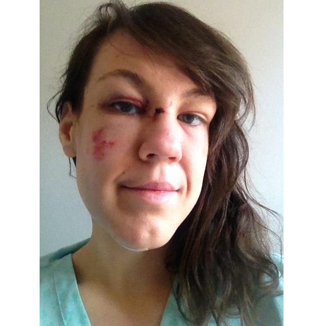 Contro la violenza sulle donne il selfie con i lividi sul volto di Jeanne Marie Ryan