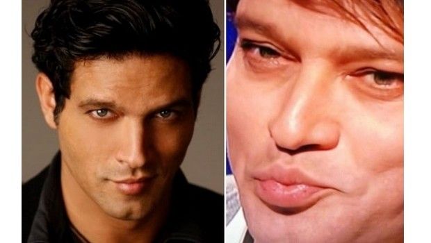 Gabriel Garko sfigurato dal botox