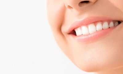 donna sorriso denti bianchi
