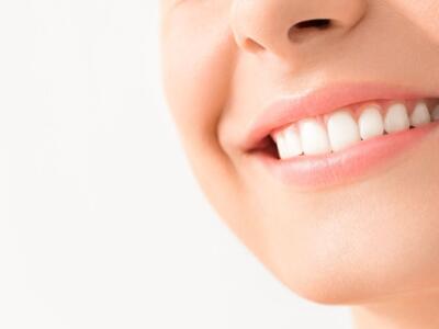 Denti bianchi, i 3 rimedi fai da te che funzionano davvero