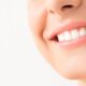 donna sorriso denti bianchi
