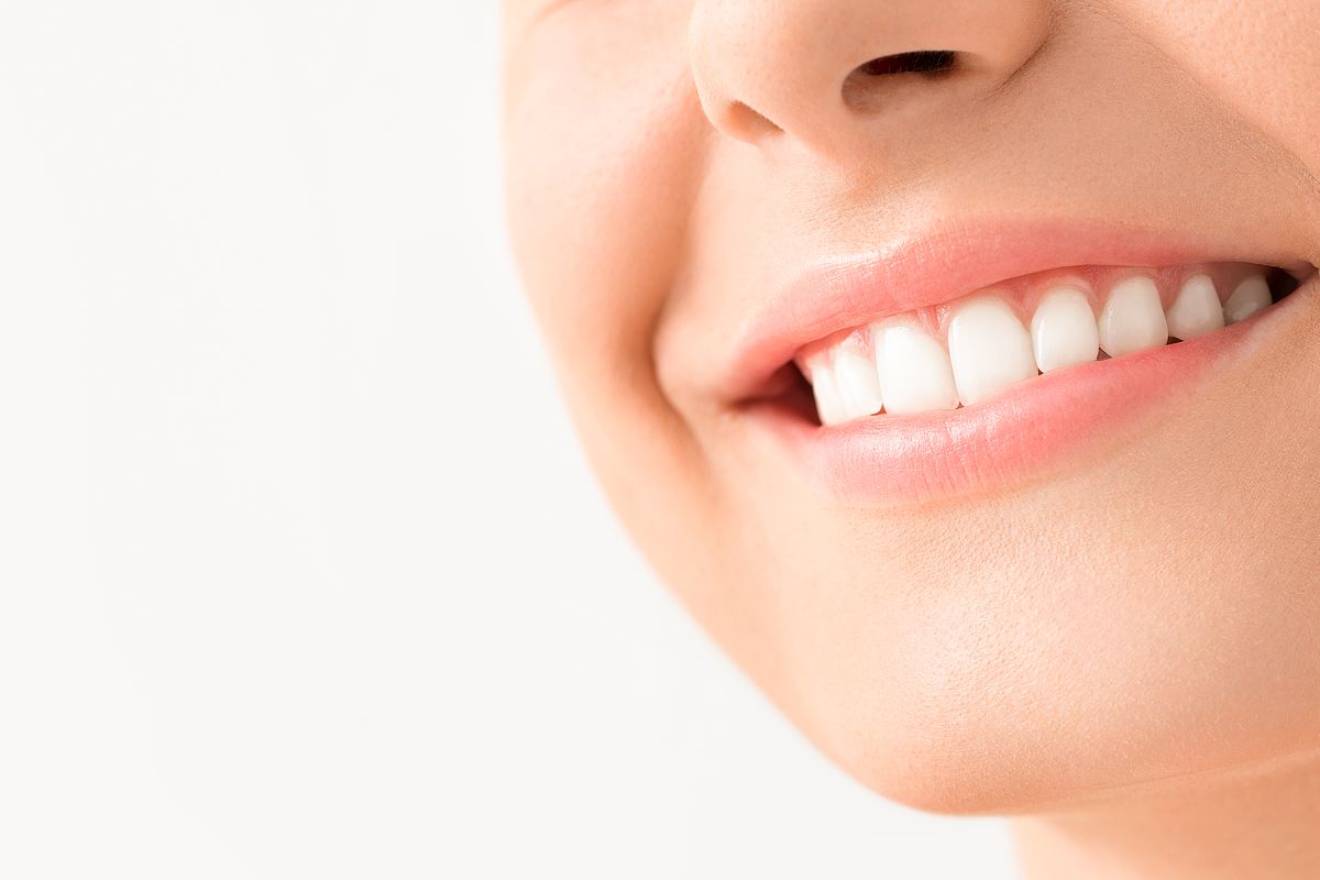 donna sorriso denti bianchi