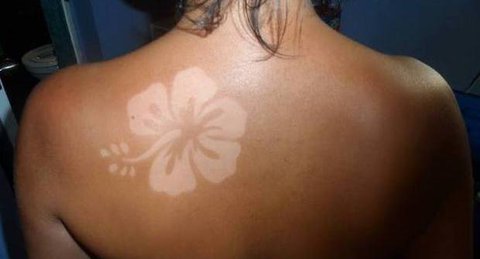 Abbronzatura decorativa, spopola in rete la pericolosa tendenza #Sunburnart