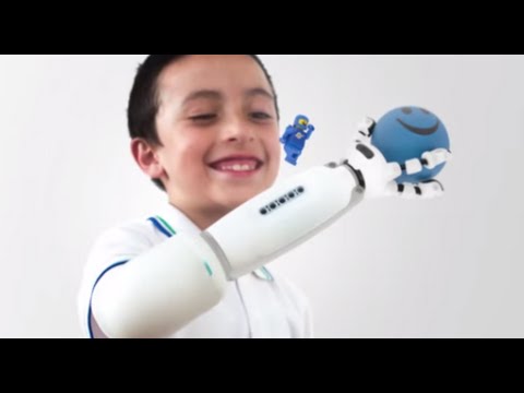 New LEGO prosthetic lets kids build their own arm