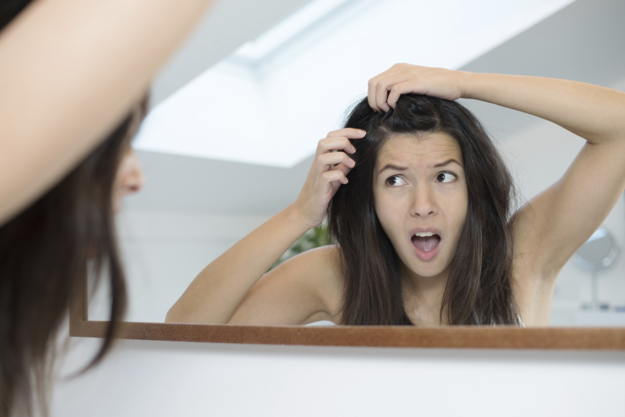 Cura dei capelli, 4 rimedi contro la forfora