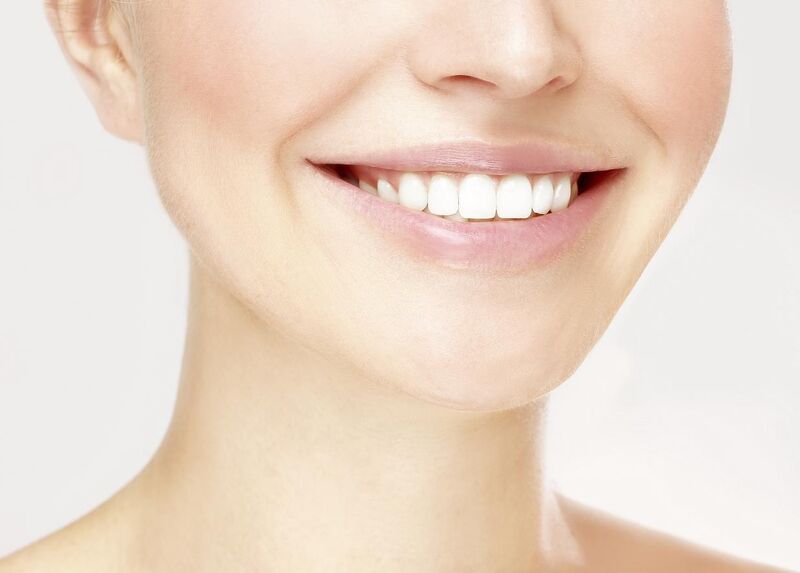 sbiancare denti