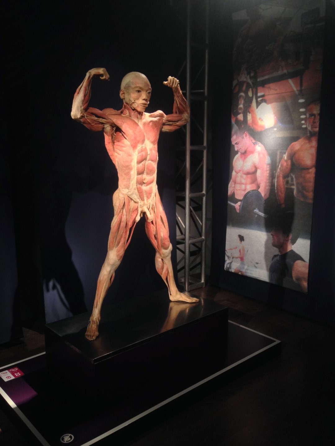 Real Bodies, operato a Milano uno dei corpi plastinati in mostra