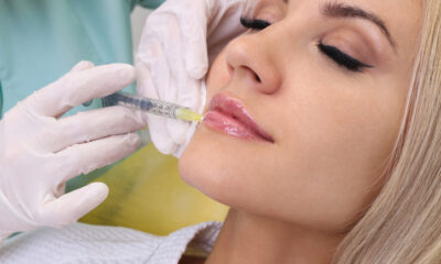 filler per le labbra
