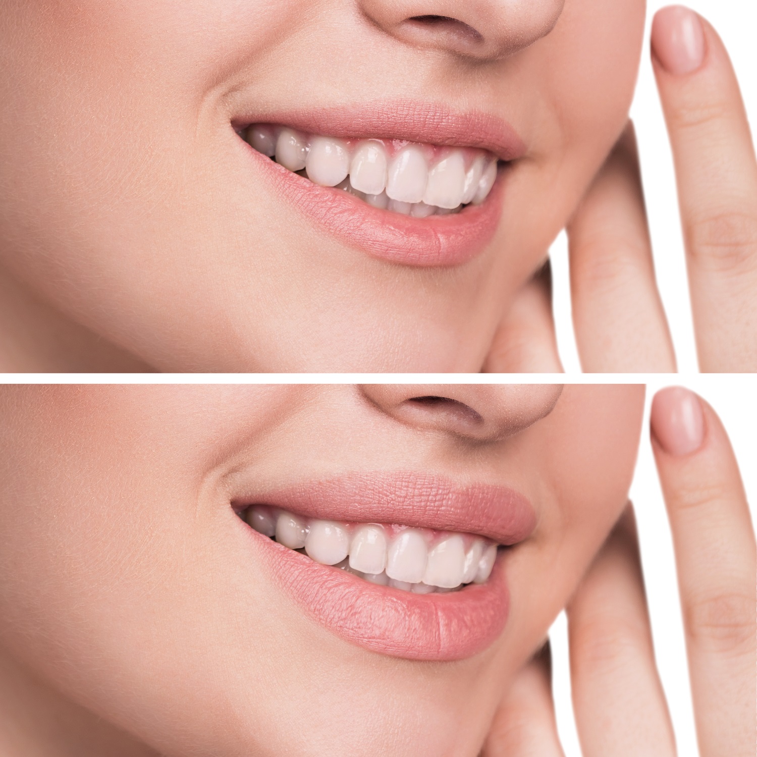 I modi efficaci per avere labbra più carnose