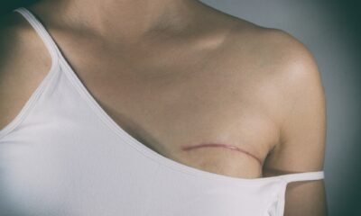 Cancro al seno
