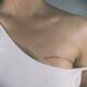 Cancro al seno