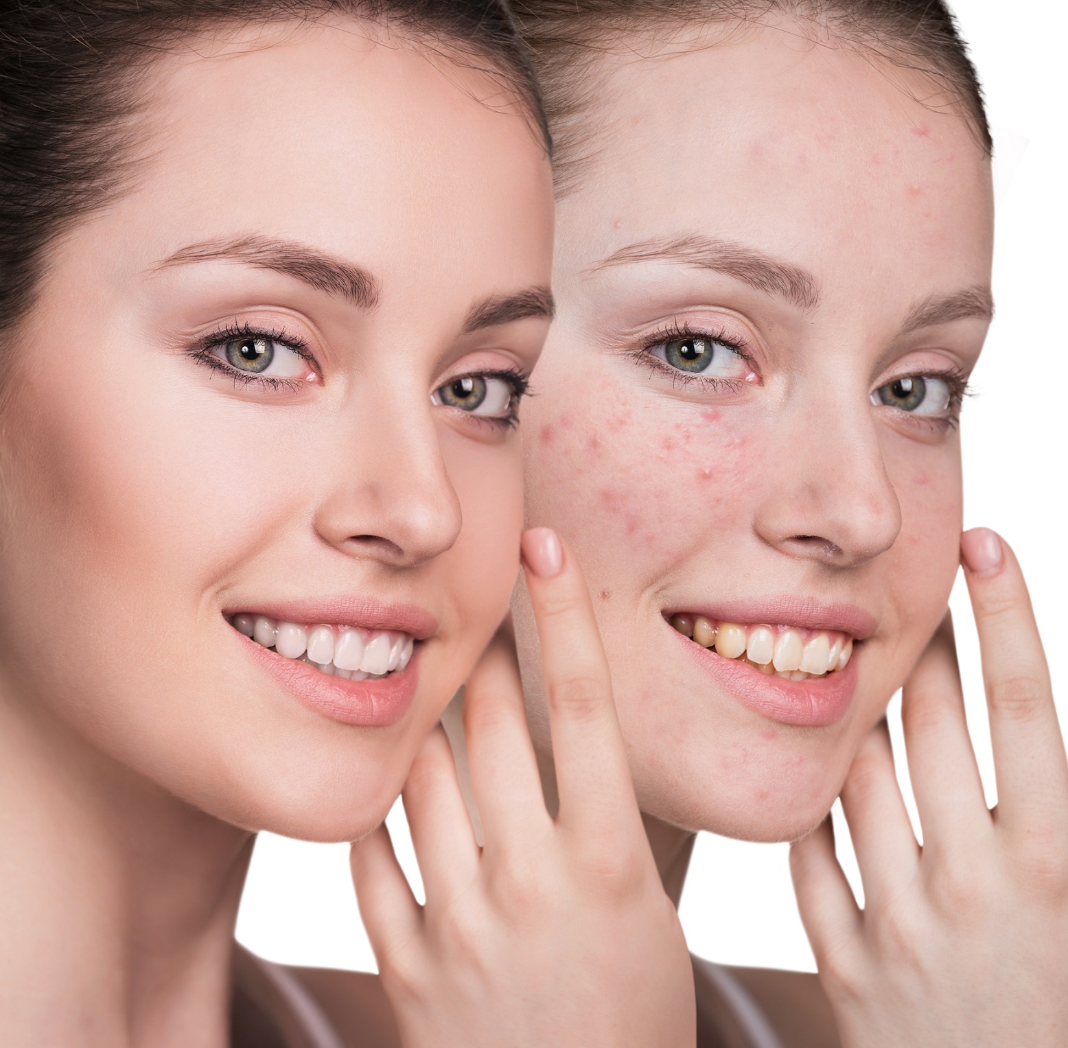 Come applicare il fondotinta minerale su una pelle giovane e acneica