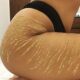 Smagliature glitterate