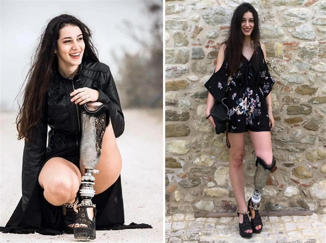 Miss Italia 2018: Chiara Bordi sfilerà con la protesi alla gamba