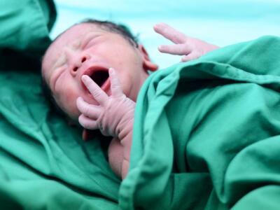 Otto embrioni nello stomaco: il caso della neonata in India