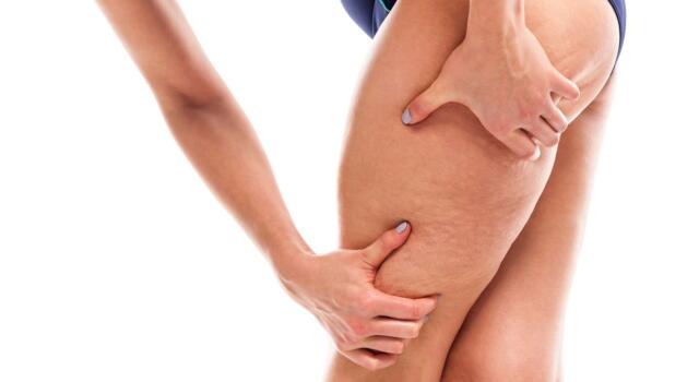 Centella asiatica contro la cellulite: cosa è e benefici