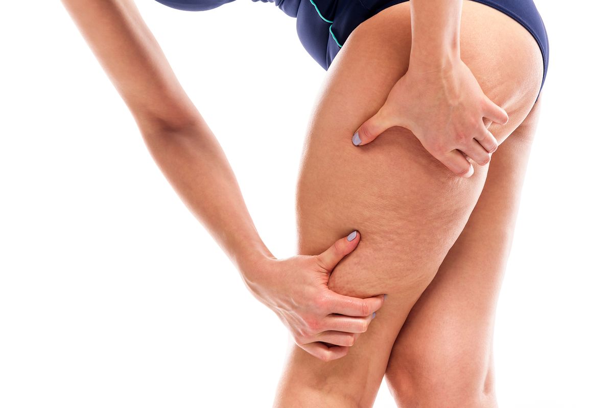 centella asiatica contro la cellulite