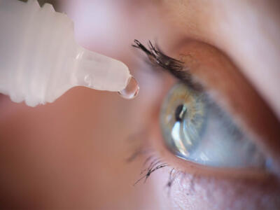 Sindrome dell’occhio secco: cosa è, sintomi e come si cura