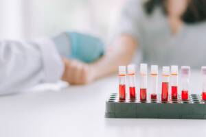 Come si dona il sangue? Ecco le informazioni fondamentali