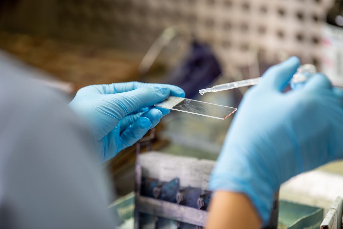 Cosa è il virus Chandipura? Ecco come si trasmette e quali sono i sintomi