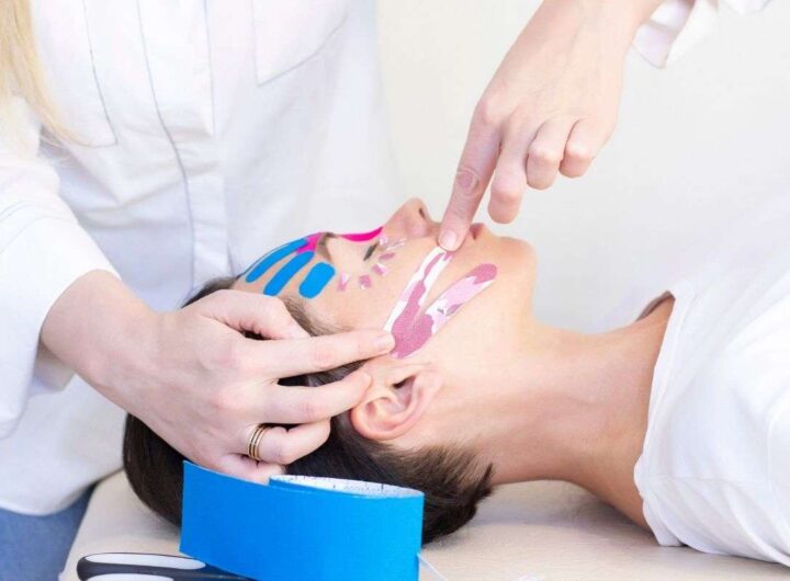 face taping benefici