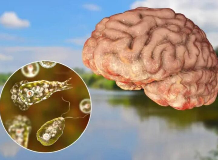 Il virus mortale in acqua
