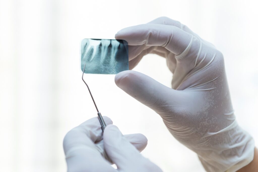 Dentista osserva una radiografia dentale.