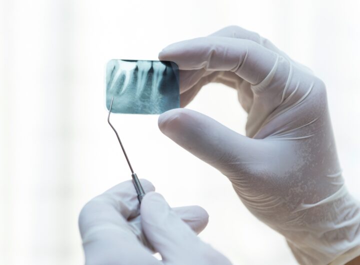 Dentista osserva una radiografia dentale.