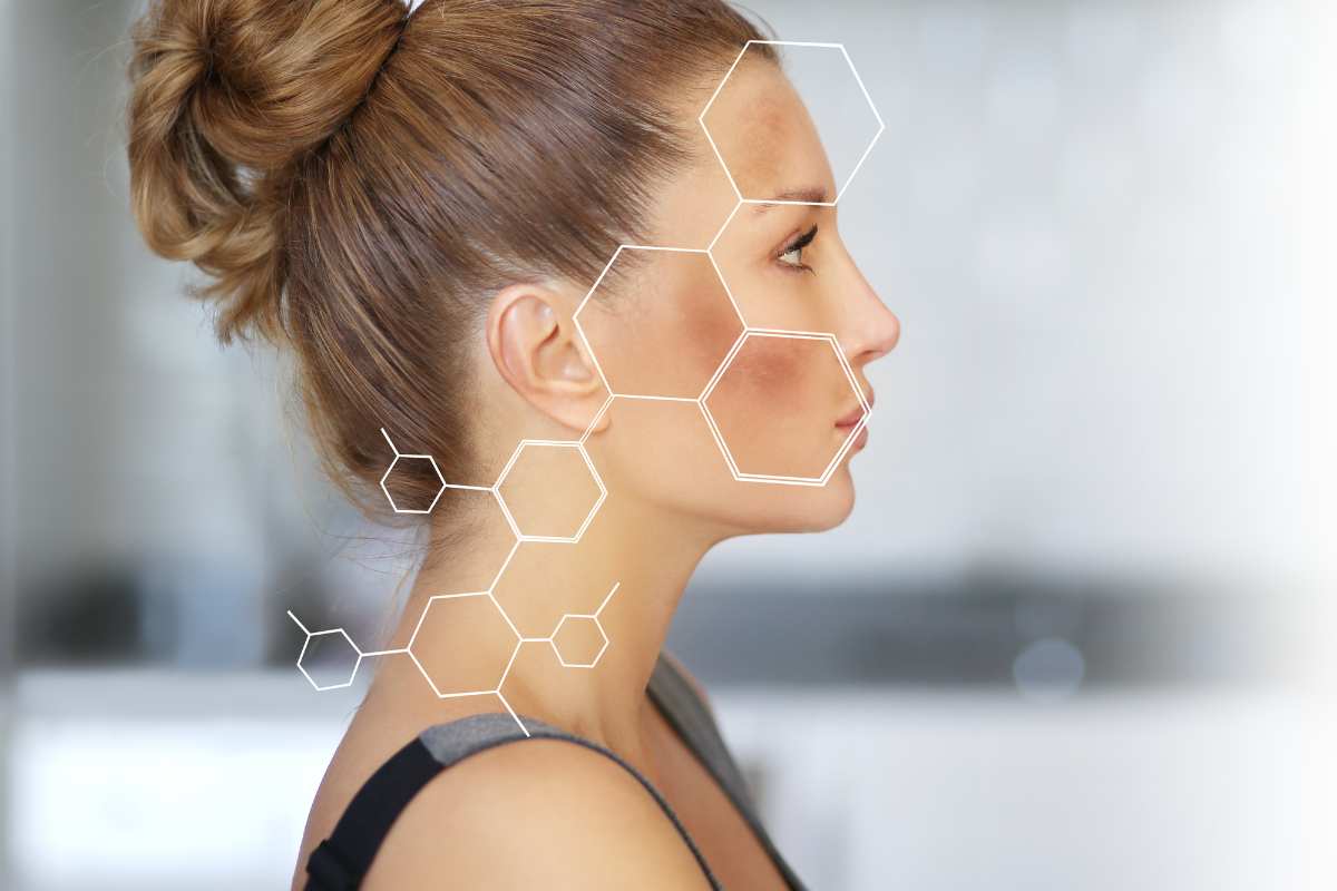 Iperpigmentazione in gravidanza